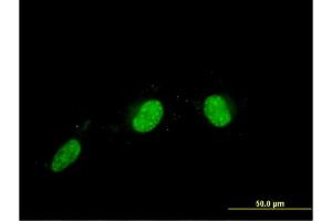 Immunofluorescence of monoclonal antibody to CALCOCO2 on HeLa cell. (CALCOCO2 抗体  (AA 347-446))