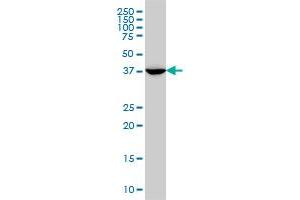 MVD monoclonal antibody (M01), clone 2A7 Western Blot analysis of MVD expression in A-431 . (MVD 抗体  (AA 301-398))