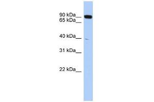 WB Suggested Anti-CXXC1 Antibody Titration:  0. (CXXC1 抗体  (Middle Region))