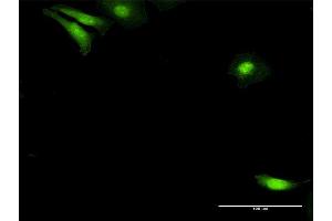 Immunofluorescence of purified MaxPab antibody to NUDC on HeLa cell. (NUDC 抗体  (AA 1-331))