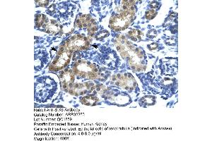 Human kidney (SIX Homeobox 6 抗体  (N-Term))