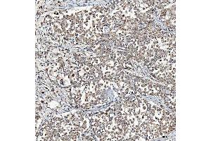 IHC analysis of SFXN3 using anti-SFXN3 antibody (ABIN7601302).