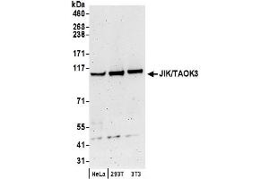 Western Blotting (WB) image for anti-TAO Kinase 3 (TAOK3) (C-Term) antibody (ABIN7450379)