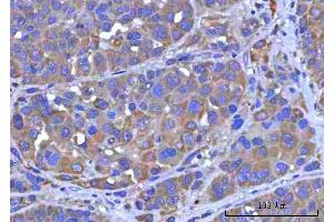 IHC analysis of PTPIP51/RMDN3 using anti-PTPIP51/RMDN3 antibody (ABIN7601775).