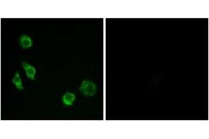 Immunofluorescence analysis of MCF7 cells, using GPRC5D Antibody. (GPRC5D 抗体  (AA 271-320))