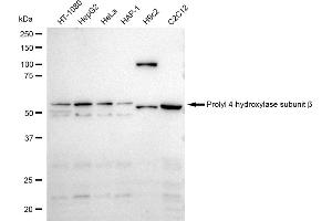 Western blotting analysis using Prolyl 4-hydroxylase subunit beta antibody (ABIN7799920). (Recombinant P4HB 抗体)