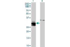Western Blot analysis of ULBP2 expression in transfected 293T cell line by ULBP2 MaxPab polyclonal antibody. (ULBP2 抗体  (AA 1-246))