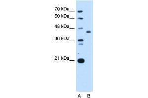 WB Suggested Anti-ST3GAL4 Antibody Titration:  0. (ST3GAL4 抗体  (Middle Region))