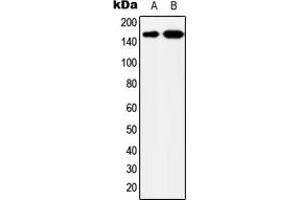 Western blot analysis of YEATS2 expression in MCF7 (A), HeLa (B) whole cell lysates. (YEATS2 抗体  (Center))