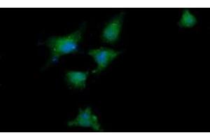 Image no. 7 for anti-DEAD (Asp-Glu-Ala-Asp) Box Polypeptide 58 (DDX58) antibody (ABIN1500708)