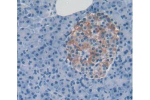 Immunohistochemistry (IHC) image for anti-Protein Tyrosine Phosphatase, Receptor Type, U (PTPRU) (AA 1263-1446) antibody (ABIN5014209)