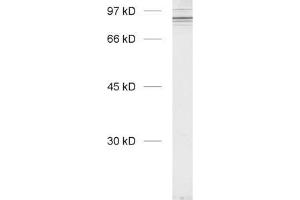 Western Blotting (WB) image for anti-Cortactin (CTTN) (N-Term) antibody (ABIN1742565)