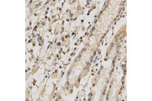 Immunohistochemistry of paraffin-embedded human stomach using RBFOX3 antibody at dilution of 1:200 (x400 lens). (NeuN 抗体)
