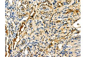 ABIN6261239 and ABIN6276806 at 1/100 staining Mouse ovarian tissue by IHC-P. (Decorin 抗体  (Internal Region))