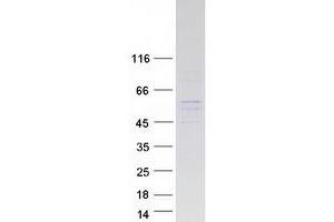 Western Blotting (WB) image for GA-Binding Protein Subunit beta-2 (GABPB2) protein (Myc-DYKDDDDK Tag) (ABIN2721530)
