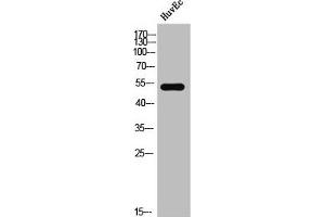 Western Blot analysis of HuvEc cells using Phospho-DAPK3 (T265) Polyclonal Antibody (DAPK3 抗体  (pThr265))