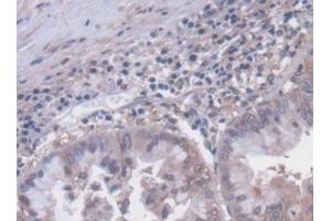 Used in DAB staining on fromalin fixed paraffin-embedded Liver tissue (SLC30A8 抗体  (AA 263-369))
