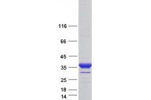Western Blotting (WB) image for B-Cell Receptor-Associated Protein 31 (BCAP31) (Transcript Variant 1) protein (Myc-DYKDDDDK Tag) (ABIN2715174)