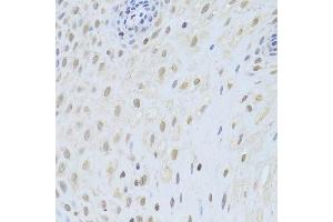 Immunohistochemistry of paraffin-embedded human esophagus using AIFM1 Antibody.