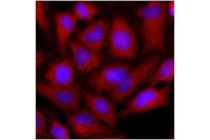 Immunofluorescenitrocellulosee of human HeLa cells stained with monoclonal anti-human OAT anitbody (1:500) with Texas Red (Red). (OAT 抗体  (AA 33-439))