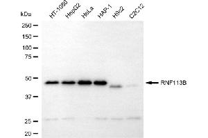 anti-Ring Finger Protein 113B (RNF113B) antibody