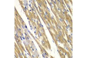 Immunohistochemistry of paraffin-embedded rat heart using TYR antibody. (TYR 抗体  (AA 20-340))