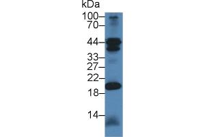 Detection of CHN2 in Mouse Cerebellum lysate using Polyclonal Antibody to Chimerin 2 (CHN2) (CHN2 抗体  (AA 101-323))