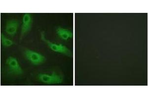 Immunofluorescence analysis of HeLa cells, using CDC37 (Ab-13) Antibody. (CDC37 抗体  (AA 1-50))