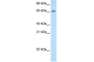 Human Thymus; WB Suggested Anti-ADAT1 Antibody Titration: 0. (ADAT1 抗体  (C-Term))