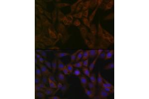 Immunofluorescence analysis of NIH-3T3 cells using  Rabbit mAb (ABIN7265484) at dilution of 1:100 (40x lens). (ARF5 抗体)