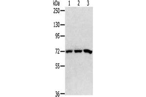 Gel: 6 % SDS-PAGE,Lysate: 40 μg,Lane 1-3: 293T cells, HepG2 cells, K562 cells,Primary antibody: ABIN7192647(SRP68 Antibody) at dilution 1/200 dilution,Secondary antibody: Goat anti rabbit IgG at 1/8000 dilution,Exposure time: 5 seconds (SRP68 抗体)