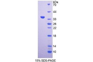 SDS-PAGE analysis of Rat AGGF1 Protein. (AGGF1 蛋白)