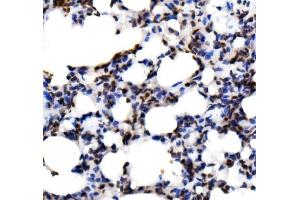 IHC analysis of KLF15 using anti-KLF15 antibody (ABIN7599269).