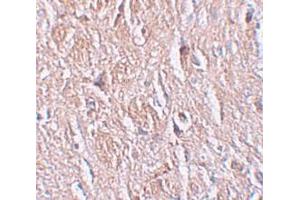 Immunohistochemistry (IHC) image for anti-Leucine Rich Repeat Transmembrane Neuronal 4 (LRRTM4) (Middle Region) antibody (ABIN1030989) (LRRTM4 抗体  (Middle Region))