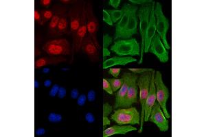 ABIN7094252 and ABIN7098299 staining Hela cells by IF/ICC.