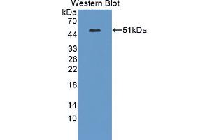 Figure. (Casein Kinase 1 delta 抗体  (AA 1-409))
