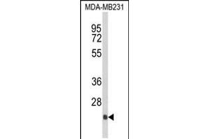 Western blot analysis of DERL2 Antibody in MDA-MB231 cell line lysates (35ug/lane) (Der1-Like Domain Family, Member 2 (DERL2) (AA 191-218), (C-Term) 抗体)