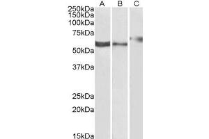 ABIN334455 (1µg/ml) staining of Human Kidney (A), Human Liver (B) and Rat Kidney (C) lysate (35µg protein in RIPA buffer). (P2RX4 抗体  (C-Term))