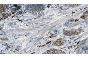 ABIN6277046 at 1/100 staining Human prostate tissue by IHC-P. (CAPZA2 抗体  (Internal Region))