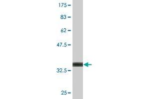 Western Blot detection against Immunogen (36. (BLMH 抗体  (AA 356-454))