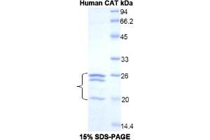 SDS-PAGE of Protein Standard from the Kit  (Highly purified E. (Catalase ELISA 试剂盒)