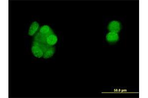 Immunofluorescence of monoclonal antibody to PGR on MCF-7 cell. (Progesterone Receptor 抗体  (AA 1-110))