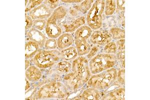 Immunohistochemistry of paraffin-embedded rat kidney using TRIM21/SS-A Rabbit pAb (ABIN6131376, ABIN6149506, ABIN6149507 and ABIN6217587) at dilution of 1:50 (40x lens). (TRIM21 抗体  (AA 80-330))