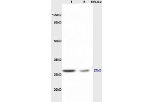 Lane 1: mouse brain lysates Lane 2: mouse liver lysates probed with Anti RPS6Polyclonal Antibody, Unconjugated (ABIN700885) at 1:200 in 4 °C. (RPS6 抗体  (AA 151-249))