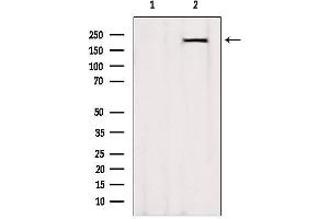 Western blot analysis of extracts from Rat heart, using MYH7-specific Antibody. (MYH7 抗体  (C-Term))