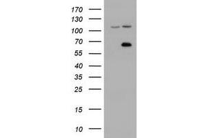 Image no. 3 for anti-Zinc Finger, Imprinted 2 (ZIM2) (AA 1-150), (AA 428-527) antibody (ABIN1490591)
