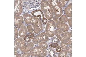 Immunohistochemical staining of human kidney with EFR3A polyclonal antibody  shows cytoplasmic positivity in tubular cells at 1:50-1:200 dilution. (EFR3A 抗体)