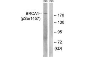 Western blot analysis of extracts from 293 cells treated with epo 20U/ml 15', using BRCA1 (Phospho-Ser1457) Antibody. (BRCA1 抗体  (pSer1457))
