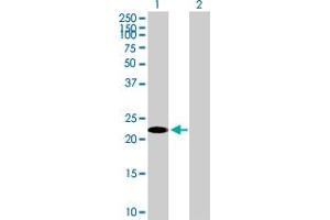 Western Blot analysis of TSC22D3 expression in transfected 293T cell line by TSC22D3 MaxPab polyclonal antibody. (TSC22D3 抗体  (AA 1-200))