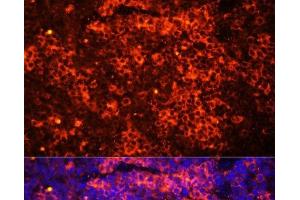 Immunofluorescence analysis of Mouse spleen using TLR8 Polyclonal Antibody at dilution of 1:100 (40x lens). (TLR8 抗体)